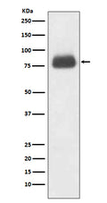 Anti-CD36/Sr B3 Rabbit Monoclonal Antibody
