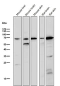 All lanes use the Antibody at 1:2K dilution for 1 hour at room temperature.