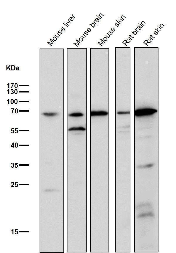 All lanes use the Antibody at 1:2K dilution for 1 hour at room temperature.