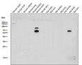 All lanes use the Antibody at 1:2K dilution for 1 hour at room temperature.