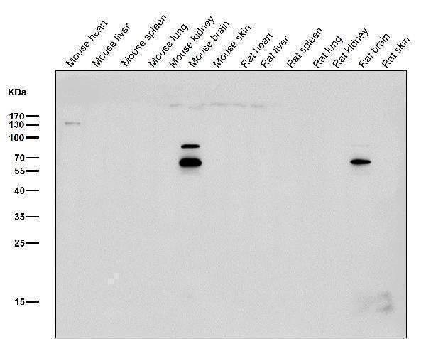 All lanes use the Antibody at 1:2K dilution for 1 hour at room temperature.