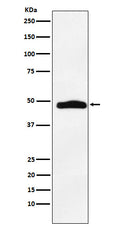 Western blot analysis of MAPKAP Kinase 2 expression in A431 cell lysate.