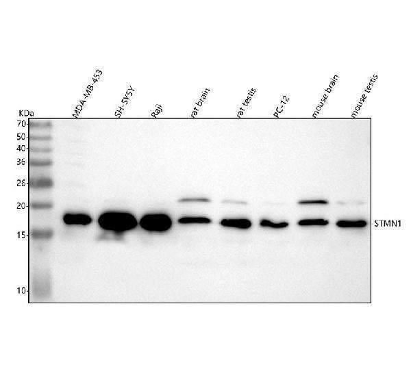 Anti-Stathmin 1 STMN1 Rabbit Monoclonal Antibody