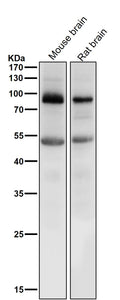 All lanes use the Antibody at 1:1K dilution for 1 hour at room temperature.