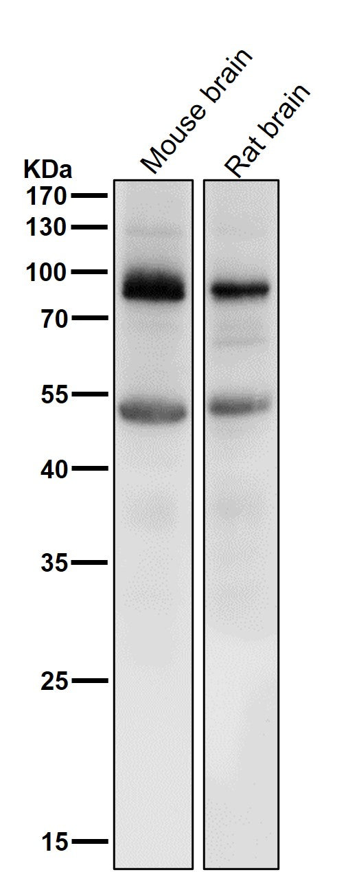 All lanes use the Antibody at 1:1K dilution for 1 hour at room temperature.