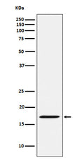 Western blot analysis of FHIT expression in Rat kidney lysate.
