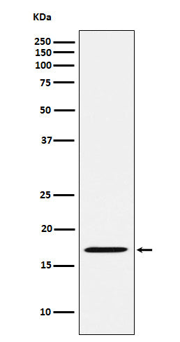 Western blot analysis of FHIT expression in Rat kidney lysate.