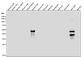 All lanes use the Antibody at 1:1W dilution for 1 hour at room temperature.