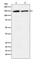 Western blot analysis of mSin3A expression in (1) K562 cell lysate; (2) RAW 264.7 cell lysate.