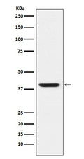 Western blot analysis of RING2 / RING1B / RNF2 expression in HeLa cell lysate.