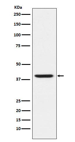 Western blot analysis of RING2 / RING1B / RNF2 expression in HeLa cell lysate.