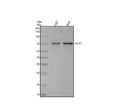 Anti-TGFBI/Beta Ig H3 Rabbit Monoclonal Antibody