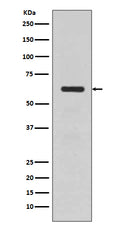 Western blot analysis of TGFBI expression in human fetal kidney lysate.