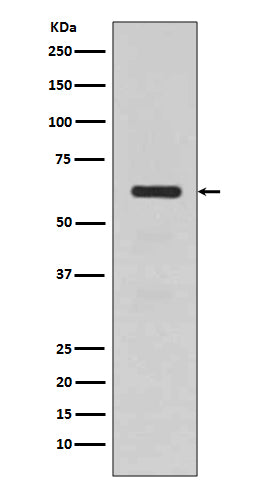 Western blot analysis of TGFBI expression in human fetal kidney lysate.