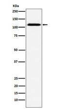 Western blot analysis of CD30 expression in A431 cell lysate.