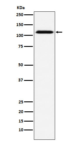 Western blot analysis of CD30 expression in A431 cell lysate.