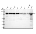 Anti-NFkB p100 / p52 Rabbit Monoclonal Antibody