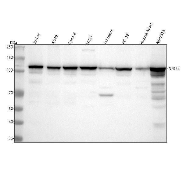 Anti-NFkB p100 / p52 Rabbit Monoclonal Antibody