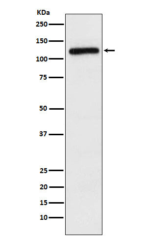 Western blot analysis of APLP2 expression in HeLa cell lysate.