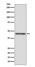 Western blot analysis of HLA G expression in Jurkat cell lysate.
