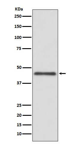 Western blot analysis of HLA G expression in Jurkat cell lysate.