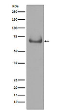 Western blot analysis of Lamin B Receptor expression in Jurkat cell lysate.