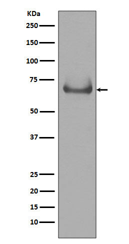 Western blot analysis of Lamin B Receptor expression in Jurkat cell lysate.