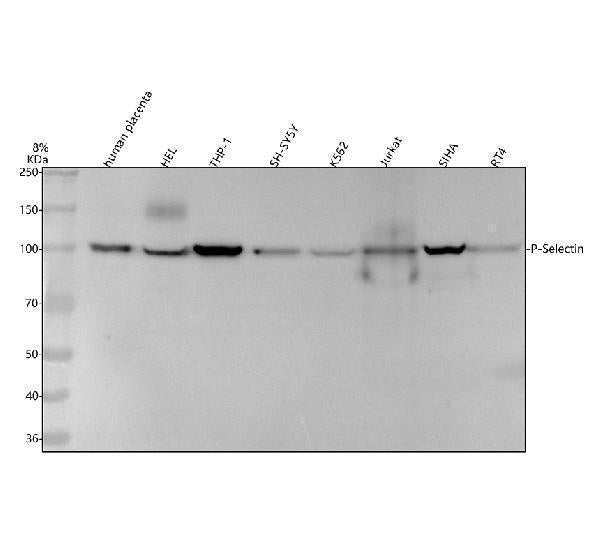 Anti-CD62P SELP Rabbit Monoclonal Antibody