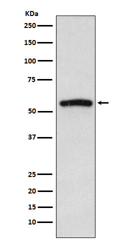 Western blot analysis of IRAK4 expression in Jurkat cell lysate.