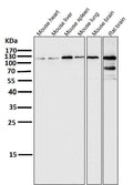 All lanes use the Antibody at 1:1K dilution for 1 hour at room temperature.
