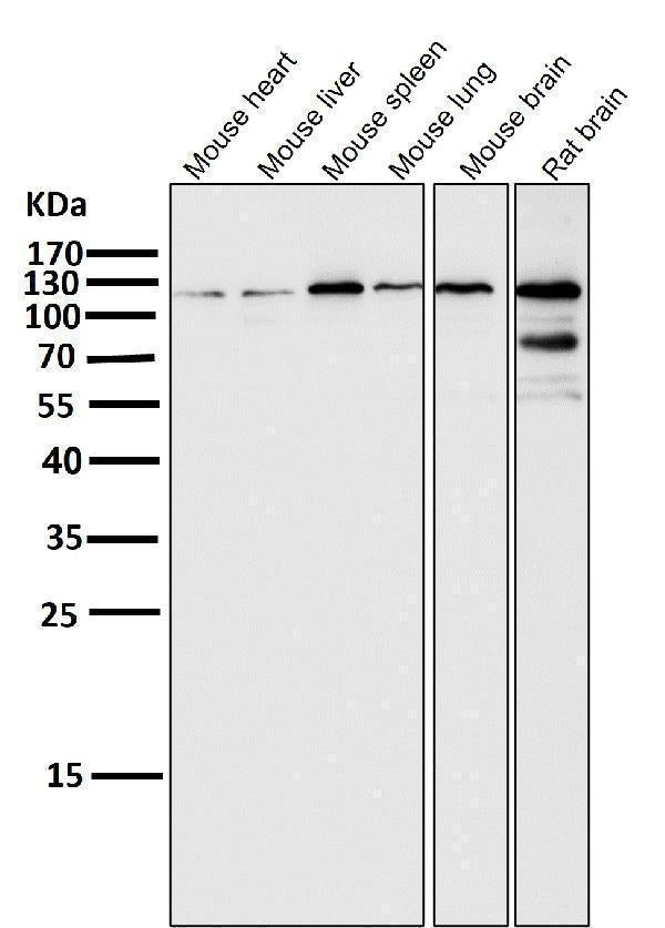 All lanes use the Antibody at 1:1K dilution for 1 hour at room temperature.