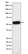 Western blot analysis of Fetuin A expression in Human plasma lysate.