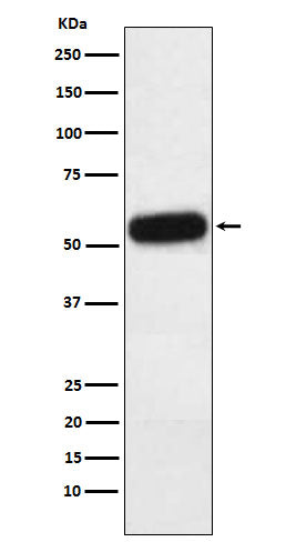 Western blot analysis of Fetuin A expression in Human plasma lysate.