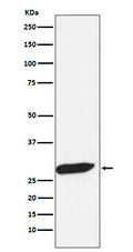 Western blot analysis of FHL1 expression in Human fetal muscle lysate.