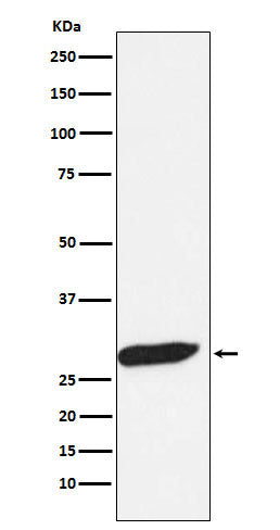 Western blot analysis of FHL1 expression in Human fetal muscle lysate.