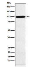 Western blot analysis of Complement factor B expression in Human plasma lysate.