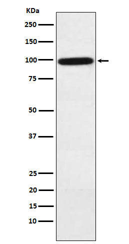 Western blot analysis of Complement factor B expression in Human plasma lysate.