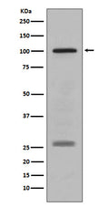 Western blot analysis of PMEL17 / GP100 expression in human melanoma lysate.