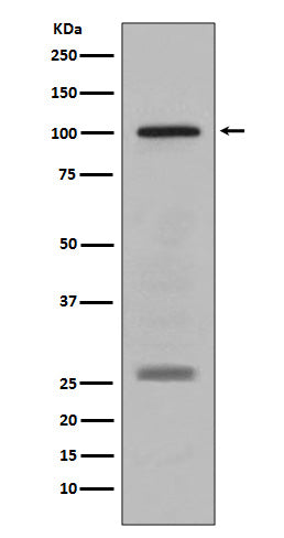 Western blot analysis of PMEL17 / GP100 expression in human melanoma lysate.
