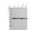 Anti-PDK1 Monoclonal Antibody