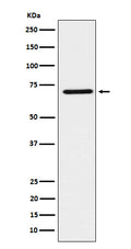 Western blot analysis of HNF1 beta expression in SK-OV-3 cell lysate.