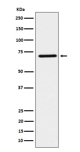 Western blot analysis of HNF1 beta expression in SK-OV-3 cell lysate.