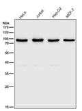 All lanes use the Antibody at 1:2W dilution for 1 hour at room temperature.