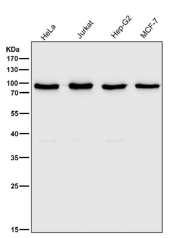 All lanes use the Antibody at 1:2W dilution for 1 hour at room temperature.