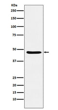 Western blot analysis of Dopamine Receptor D3 expression in SH-SY5Y cell lysate.
