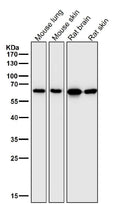 All lanes use the Antibody at 1:1W dilution for 1 hour at room temperature.