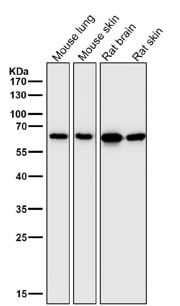 All lanes use the Antibody at 1:1W dilution for 1 hour at room temperature.