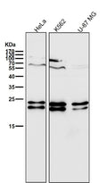 All lanes use the Antibody at 1:2K dilution for 1 hour at room temperature.
