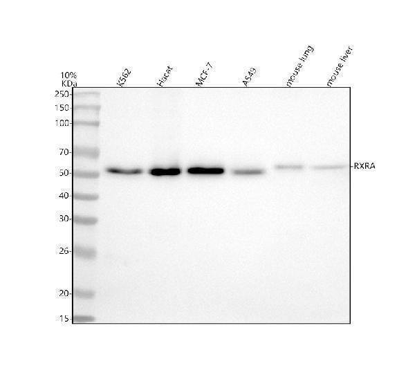 Anti-Retinoid X Receptor alpha Rabbit Monoclonal Antibody