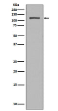 Western blot analysis of NUP98 expression in HeLa cell lysate.